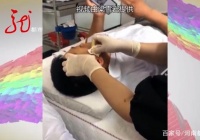 男的做了个线雕整容，但是美容院负责人失联了！